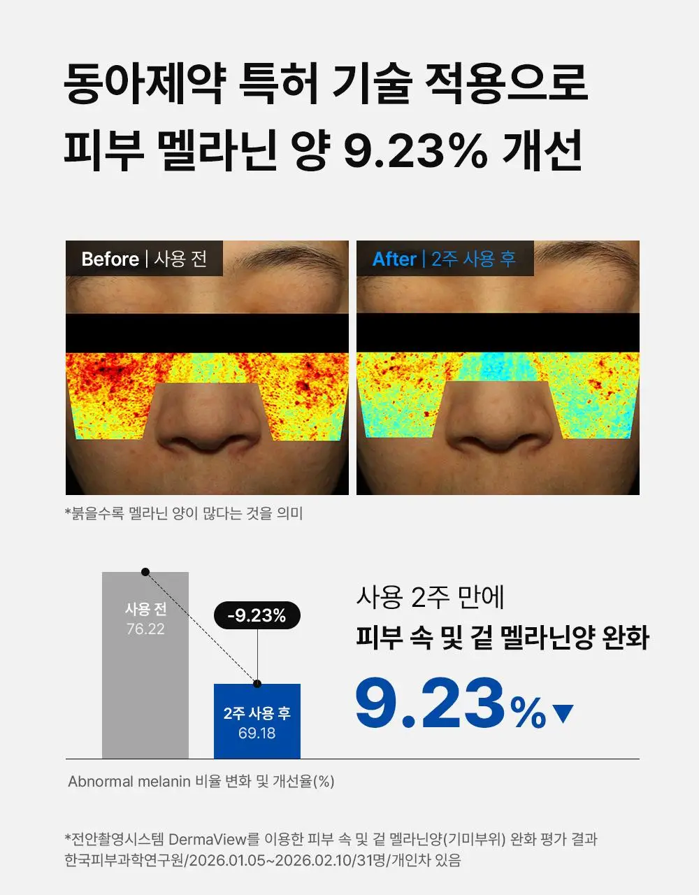 [단독기획] 동아제약 색소침착 프로 크림제 40ml 기획(+5ml*2) 상세페이지 13